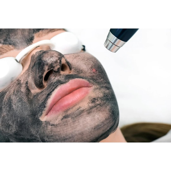 Laser-Hair-Removal.png